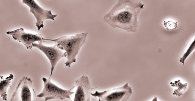 European Academies of Science and Medicine on Regenerative Medicine: Great Medical Promises Threatened by Booming Miracle Cures and Undue Pressure to Gain Fast-Track Approvals